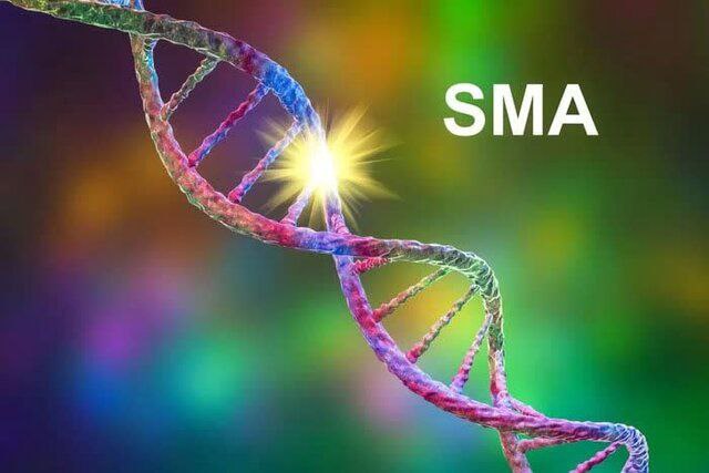 غربالگری بیماری SMA از امسال با کیت تشخیصی ایرانی
