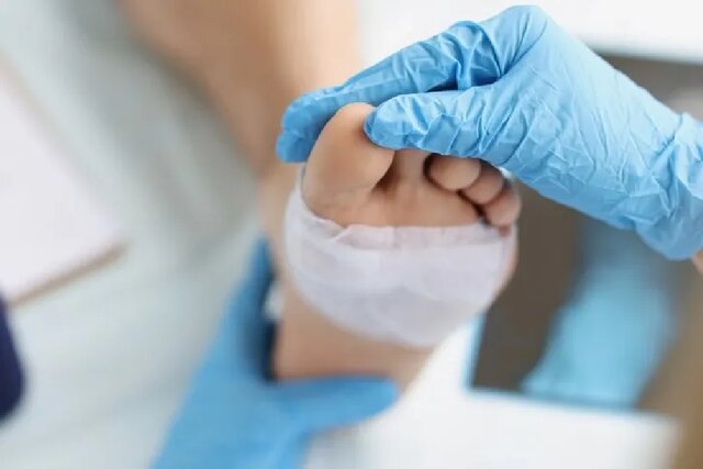 وب‌سایت رسمی موسسه کارولینسکا: مولکول مهم ترمیم زخم کشف شد